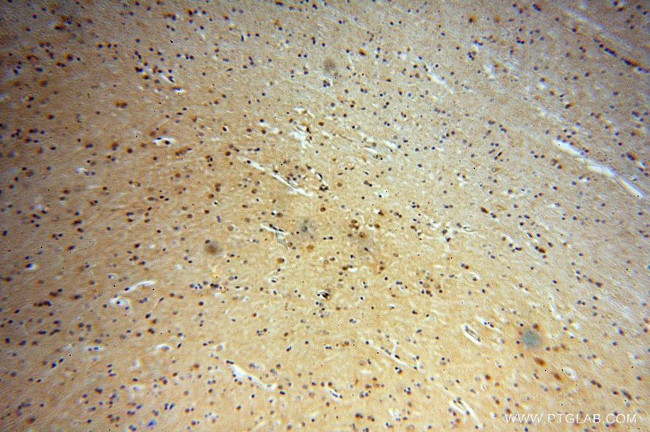 YPEL1 Antibody in Immunohistochemistry (Paraffin) (IHC (P))