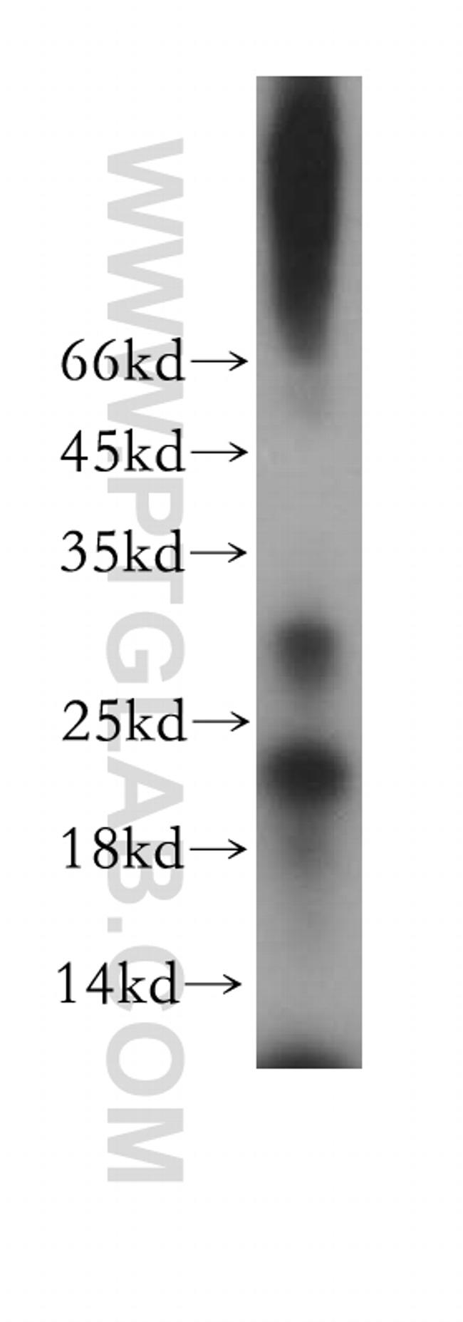 YPEL1 Antibody in Western Blot (WB)