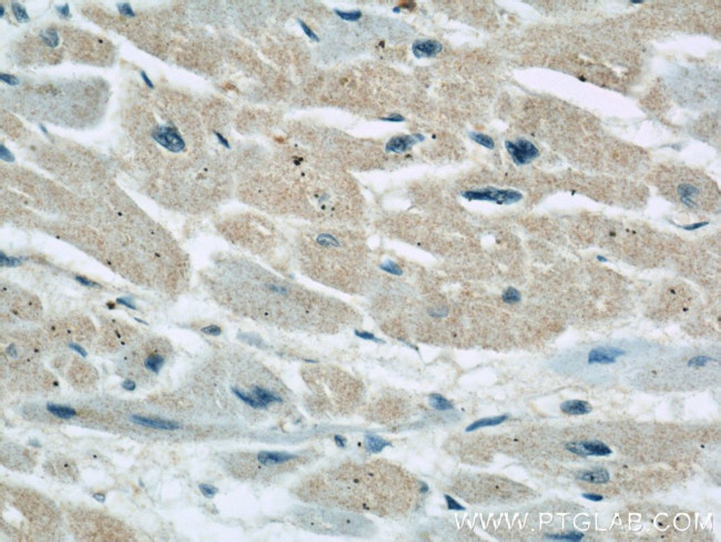 GRAF Antibody in Immunohistochemistry (Paraffin) (IHC (P))