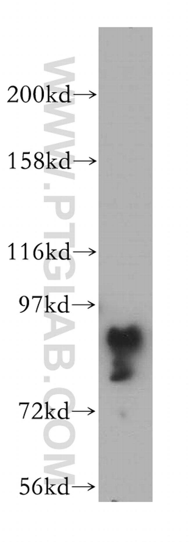 GRAF Antibody in Western Blot (WB)