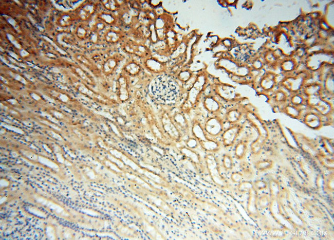 CHST14 Antibody in Immunohistochemistry (Paraffin) (IHC (P))