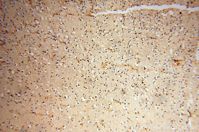 CHST14 Antibody in Immunohistochemistry (Paraffin) (IHC (P))