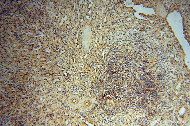 CHST14 Antibody in Immunohistochemistry (Paraffin) (IHC (P))