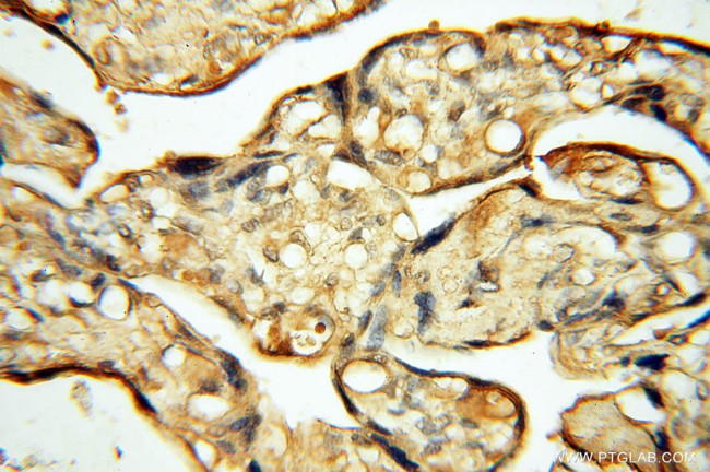 CHST14 Antibody in Immunohistochemistry (Paraffin) (IHC (P))