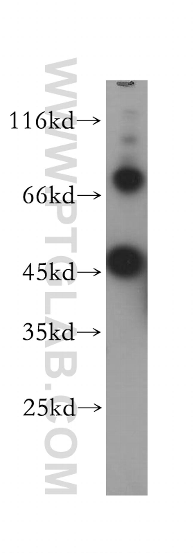 CHST14 Antibody in Western Blot (WB)