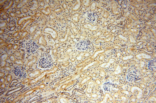 LSG1 Antibody in Immunohistochemistry (Paraffin) (IHC (P))