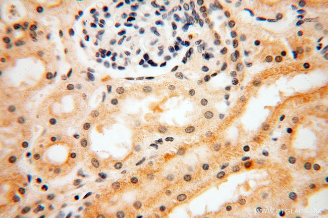 LSG1 Antibody in Immunohistochemistry (Paraffin) (IHC (P))