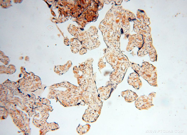 LSG1 Antibody in Immunohistochemistry (Paraffin) (IHC (P))