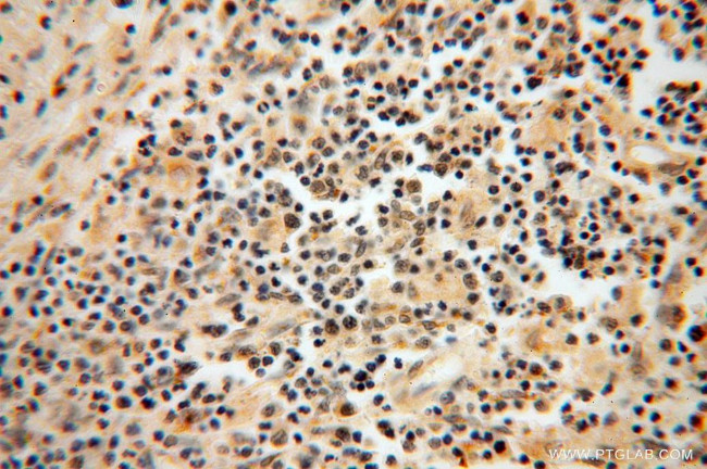 LSG1 Antibody in Immunohistochemistry (Paraffin) (IHC (P))