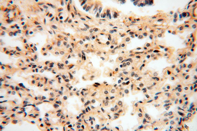 LSG1 Antibody in Immunohistochemistry (Paraffin) (IHC (P))