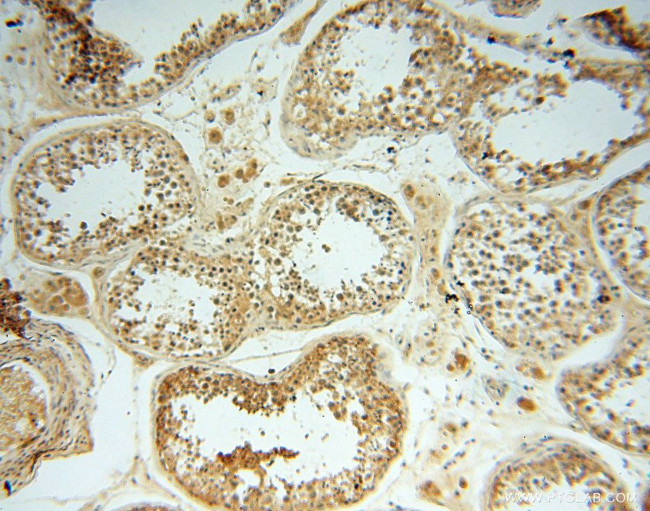 LSG1 Antibody in Immunohistochemistry (Paraffin) (IHC (P))