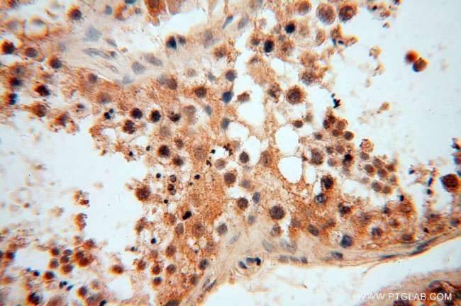 LSG1 Antibody in Immunohistochemistry (Paraffin) (IHC (P))