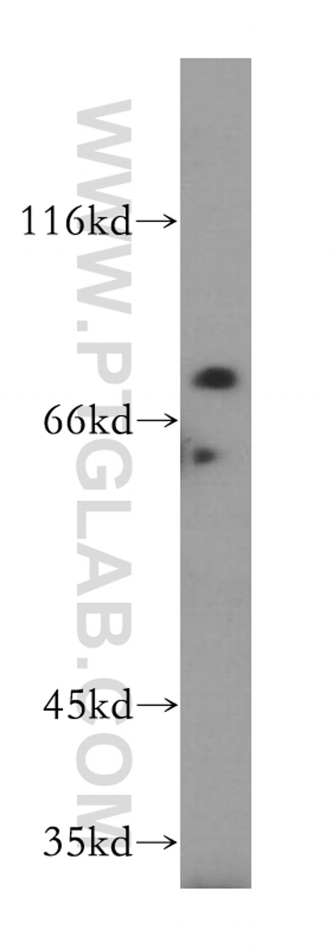 LSG1 Antibody in Western Blot (WB)