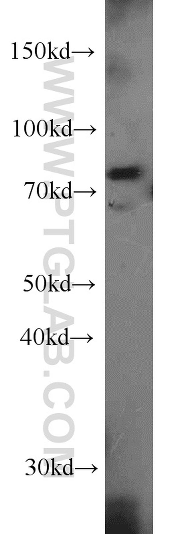 LSG1 Antibody in Western Blot (WB)