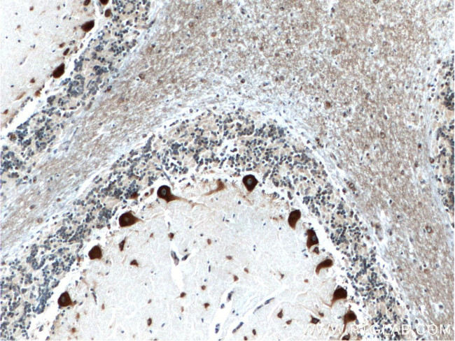 NUFIP2 Antibody in Immunohistochemistry (Paraffin) (IHC (P))