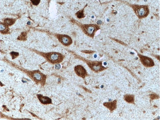 NUFIP2 Antibody in Immunohistochemistry (Paraffin) (IHC (P))