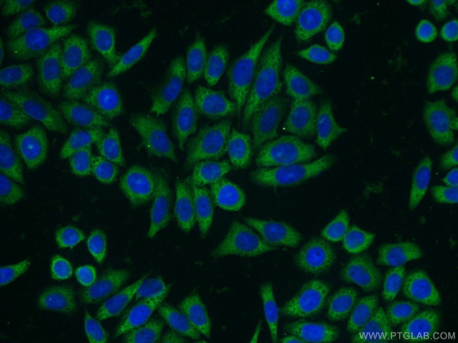 RANBP9 Antibody in Immunocytochemistry (ICC/IF)