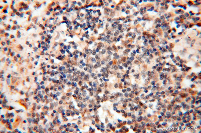 RANBP9 Antibody in Immunohistochemistry (Paraffin) (IHC (P))