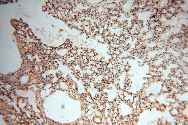 RANBP9 Antibody in Immunohistochemistry (Paraffin) (IHC (P))