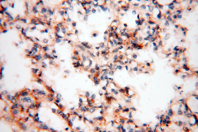 RANBP9 Antibody in Immunohistochemistry (Paraffin) (IHC (P))