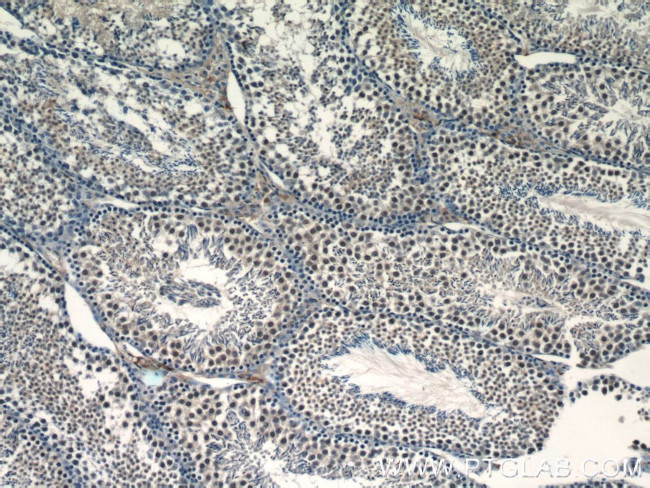 RANBP9 Antibody in Immunohistochemistry (Paraffin) (IHC (P))