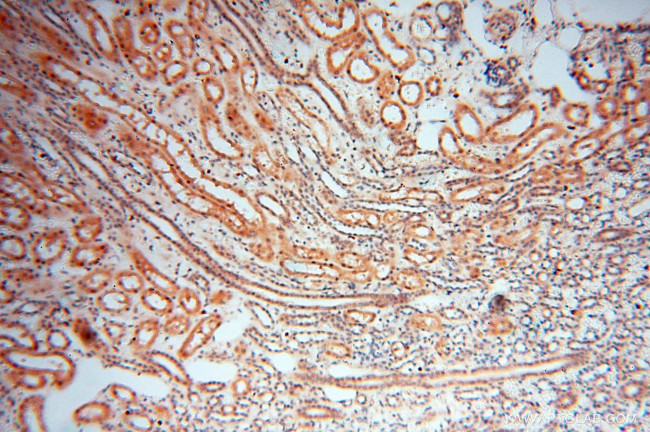 RANBP9 Antibody in Immunohistochemistry (Paraffin) (IHC (P))