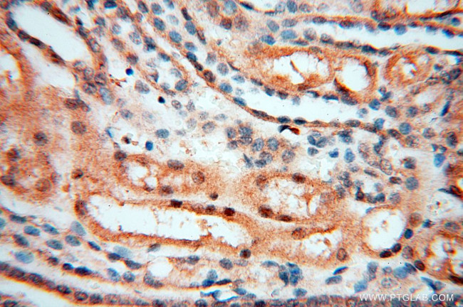 RANBP9 Antibody in Immunohistochemistry (Paraffin) (IHC (P))