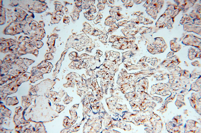 RANBP9 Antibody in Immunohistochemistry (Paraffin) (IHC (P))