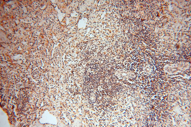 RANBP9 Antibody in Immunohistochemistry (Paraffin) (IHC (P))