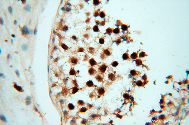 RANBP9 Antibody in Immunohistochemistry (Paraffin) (IHC (P))