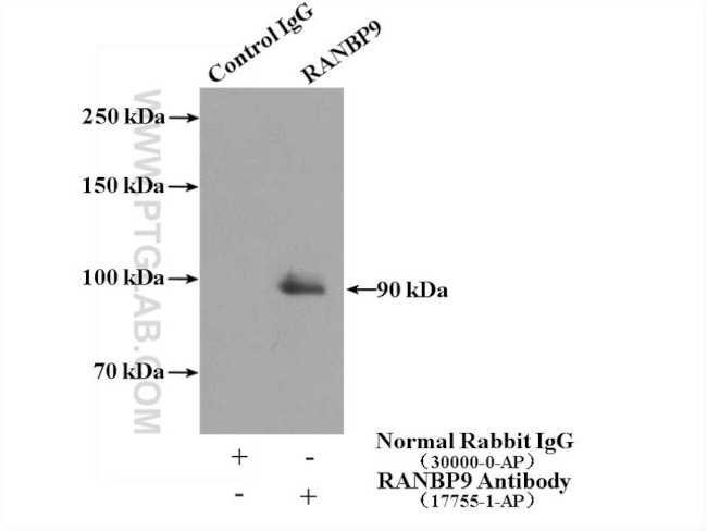 RANBP9 Antibody in Immunoprecipitation (IP)