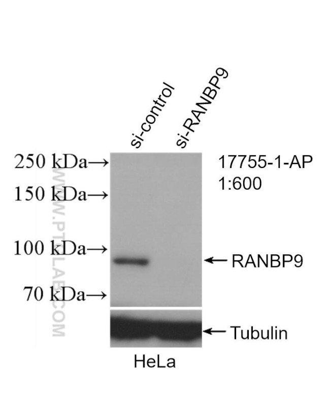 RANBP9 Antibody in Western Blot (WB)