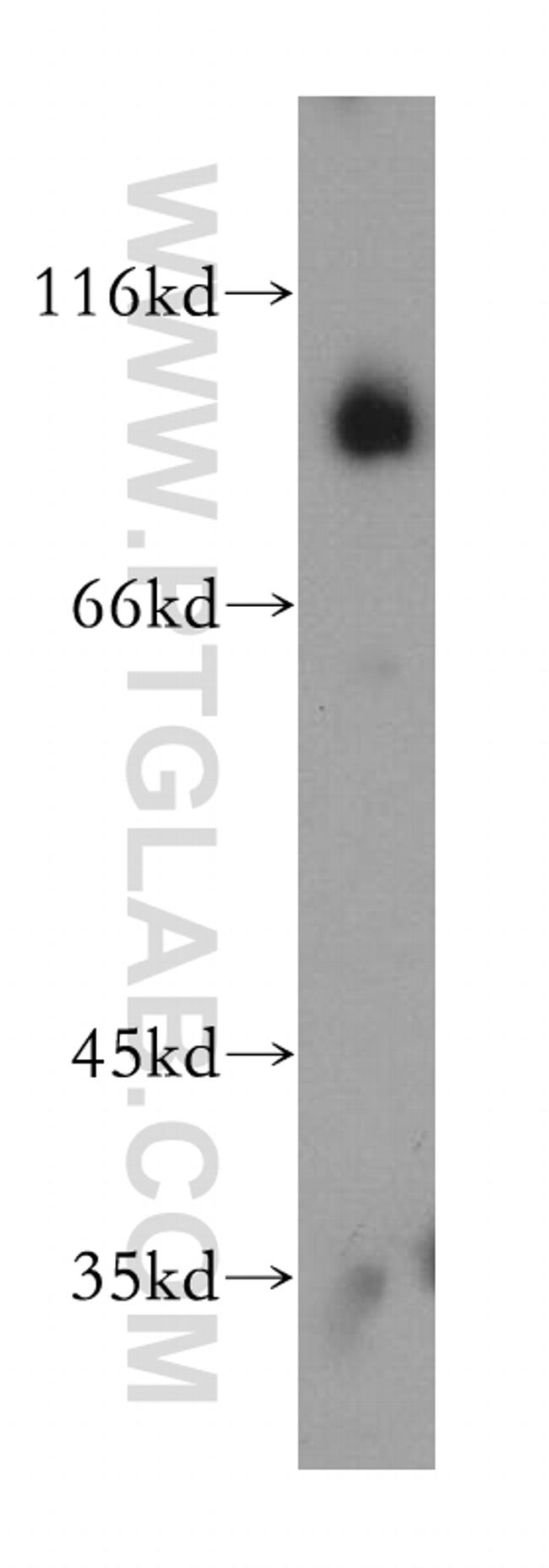 RANBP9 Antibody in Western Blot (WB)