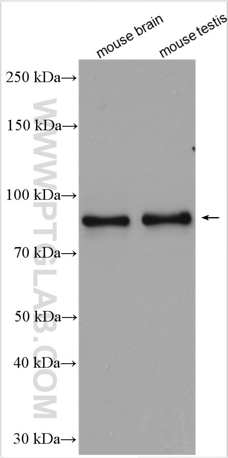 RANBP9 Antibody in Western Blot (WB)