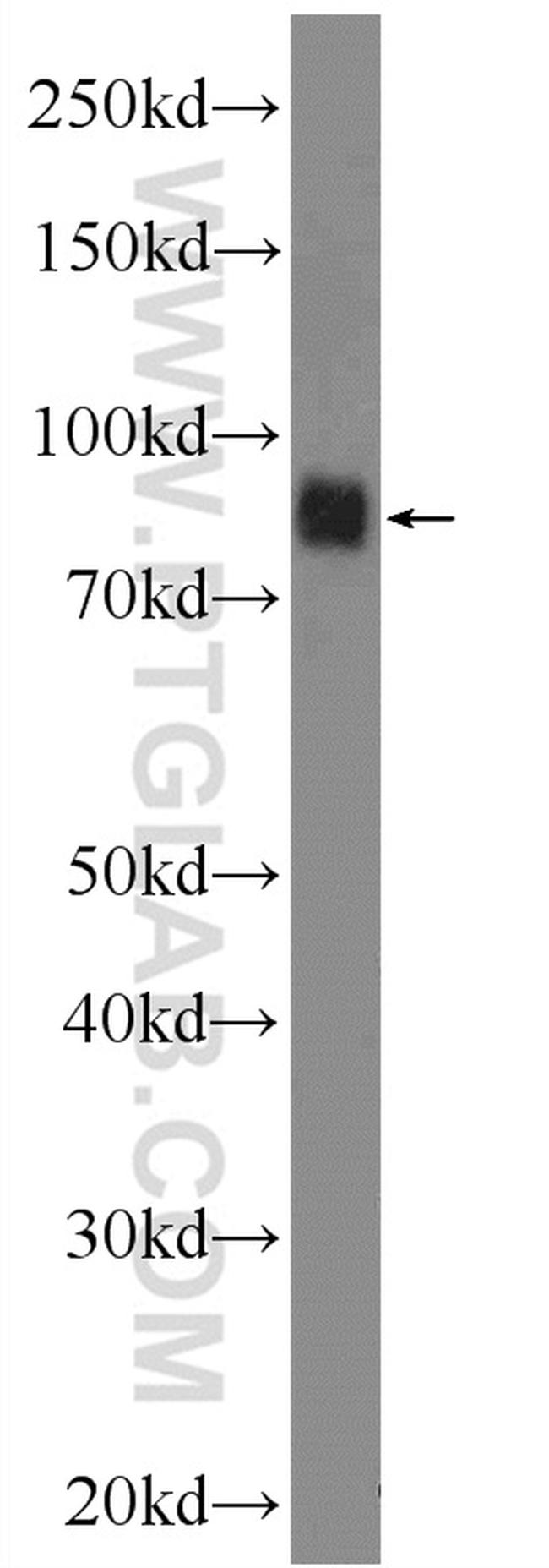 RANBP9 Antibody in Western Blot (WB)