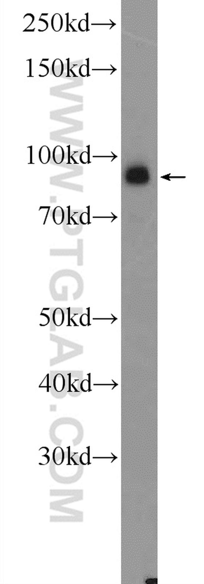 RANBP9 Antibody in Western Blot (WB)