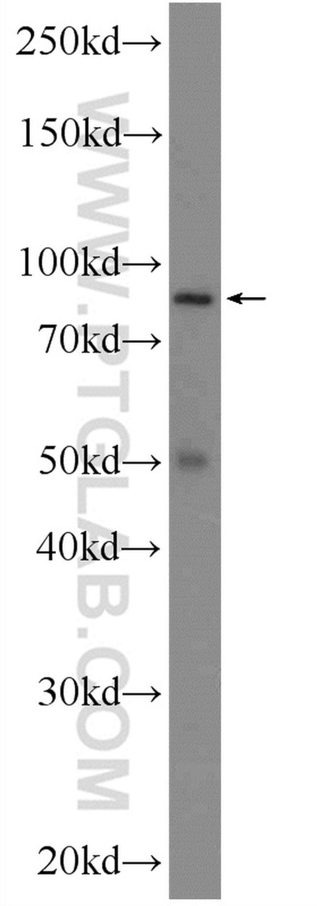 RANBP9 Antibody in Western Blot (WB)