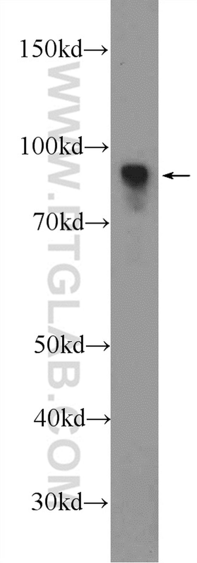 RANBP9 Antibody in Western Blot (WB)