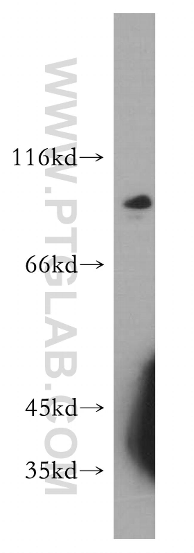 SPIRE2 Antibody in Western Blot (WB)