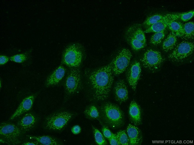 CNDP1 Antibody in Immunocytochemistry (ICC/IF)