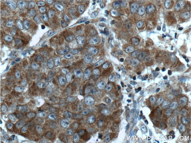 CNDP1 Antibody in Immunohistochemistry (Paraffin) (IHC (P))