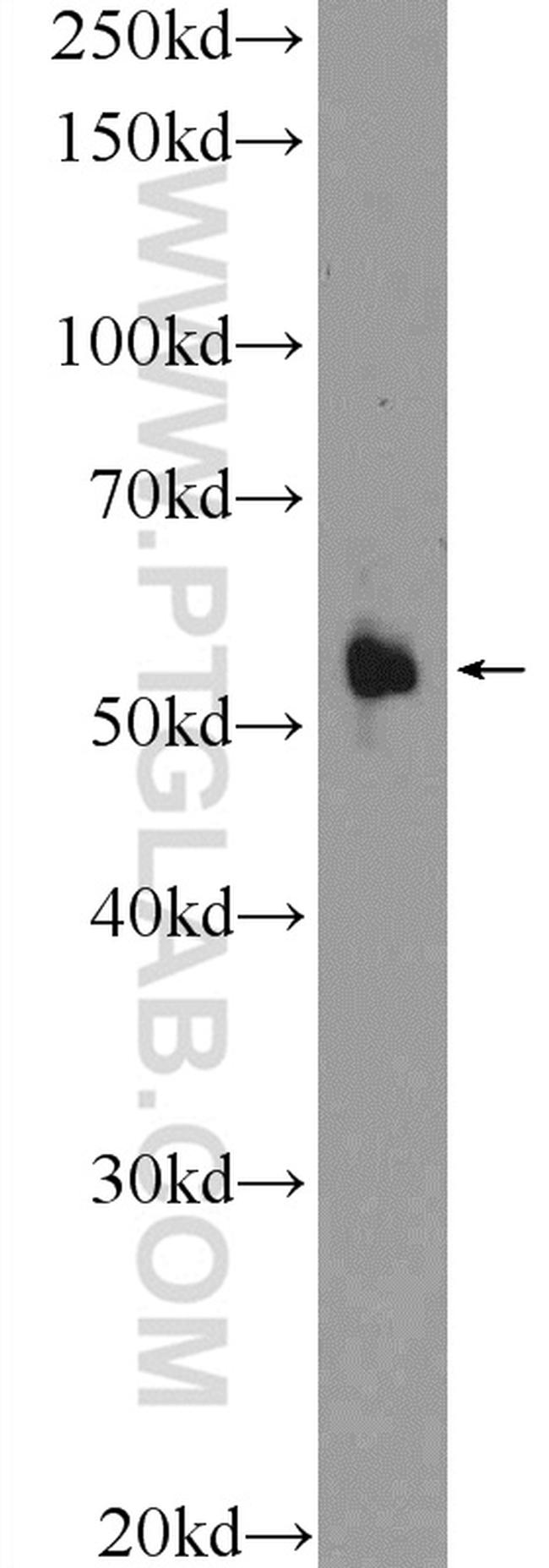 CNDP1 Antibody in Western Blot (WB)