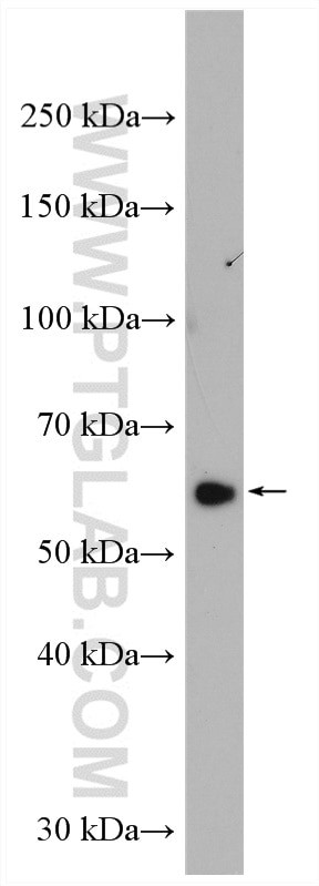 CORO1A Antibody in Western Blot (WB)