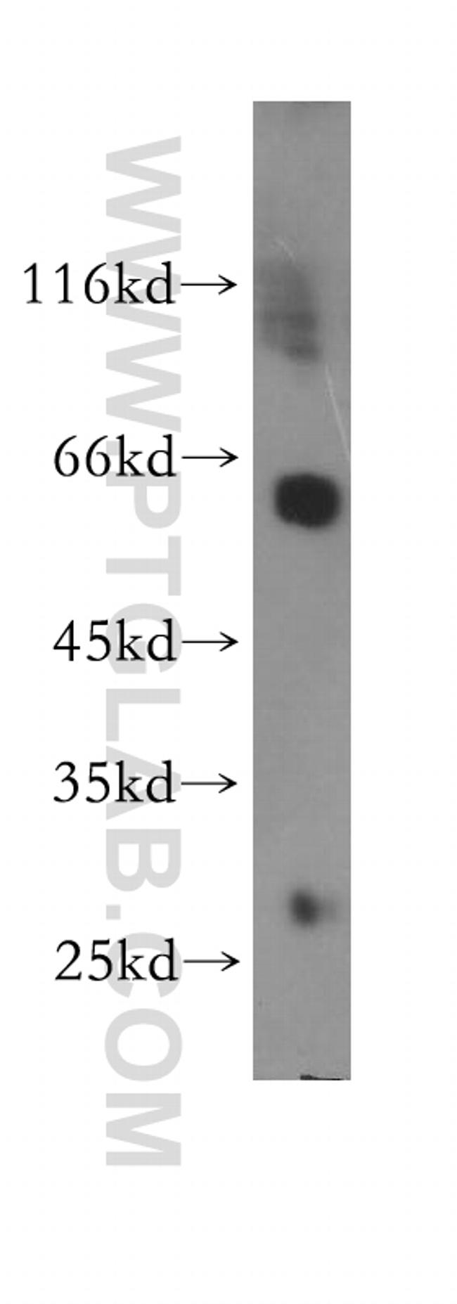 CORO1A Antibody in Western Blot (WB)