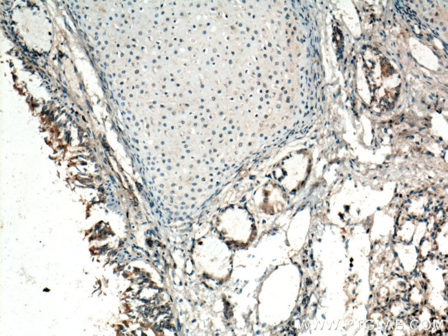 GM-CSF Antibody in Immunohistochemistry (Paraffin) (IHC (P))