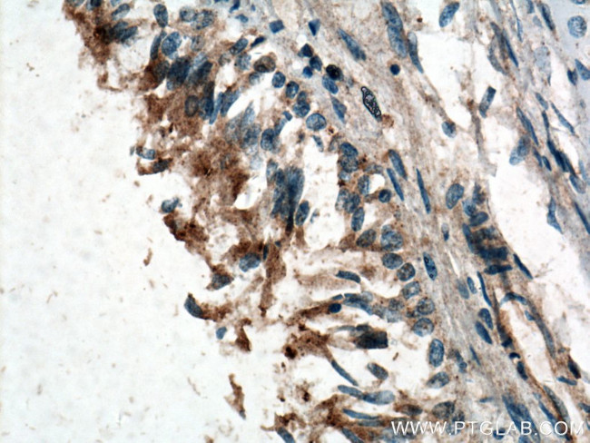 GM-CSF Antibody in Immunohistochemistry (Paraffin) (IHC (P))