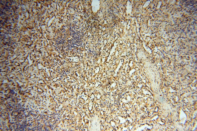 GM-CSF Antibody in Immunohistochemistry (Paraffin) (IHC (P))