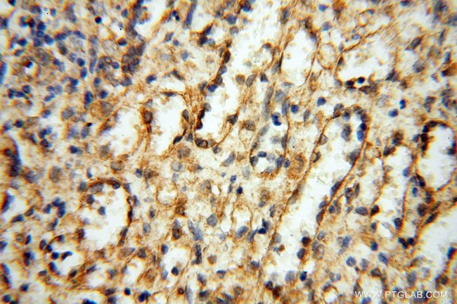 GM-CSF Antibody in Immunohistochemistry (Paraffin) (IHC (P))