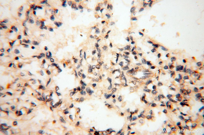 GM-CSF Antibody in Immunohistochemistry (Paraffin) (IHC (P))