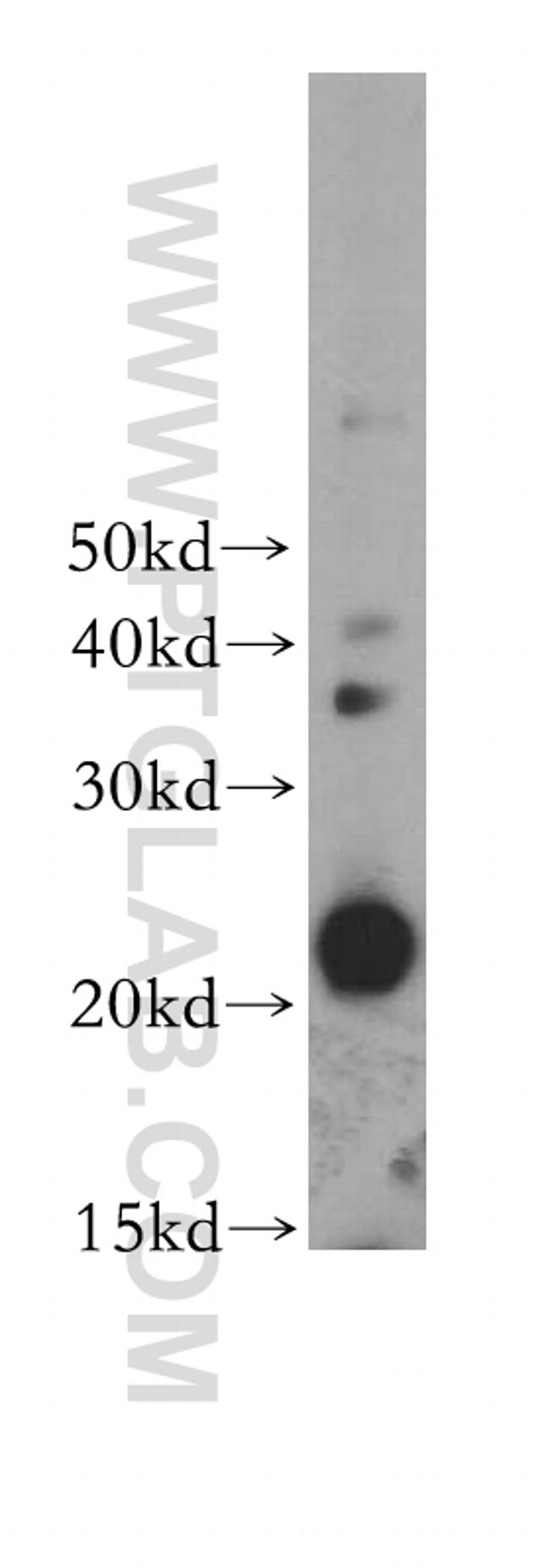 GM-CSF Antibody in Western Blot (WB)